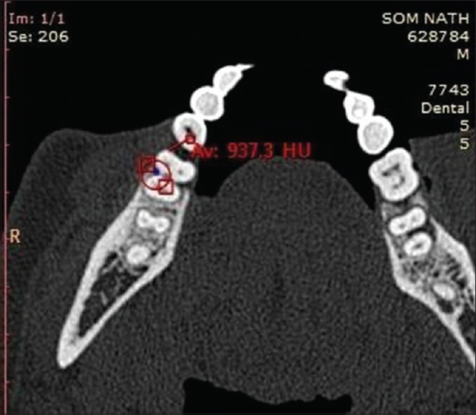 Figure 13