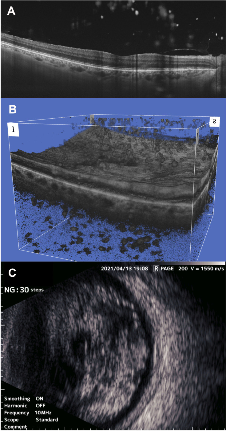 Figure 2