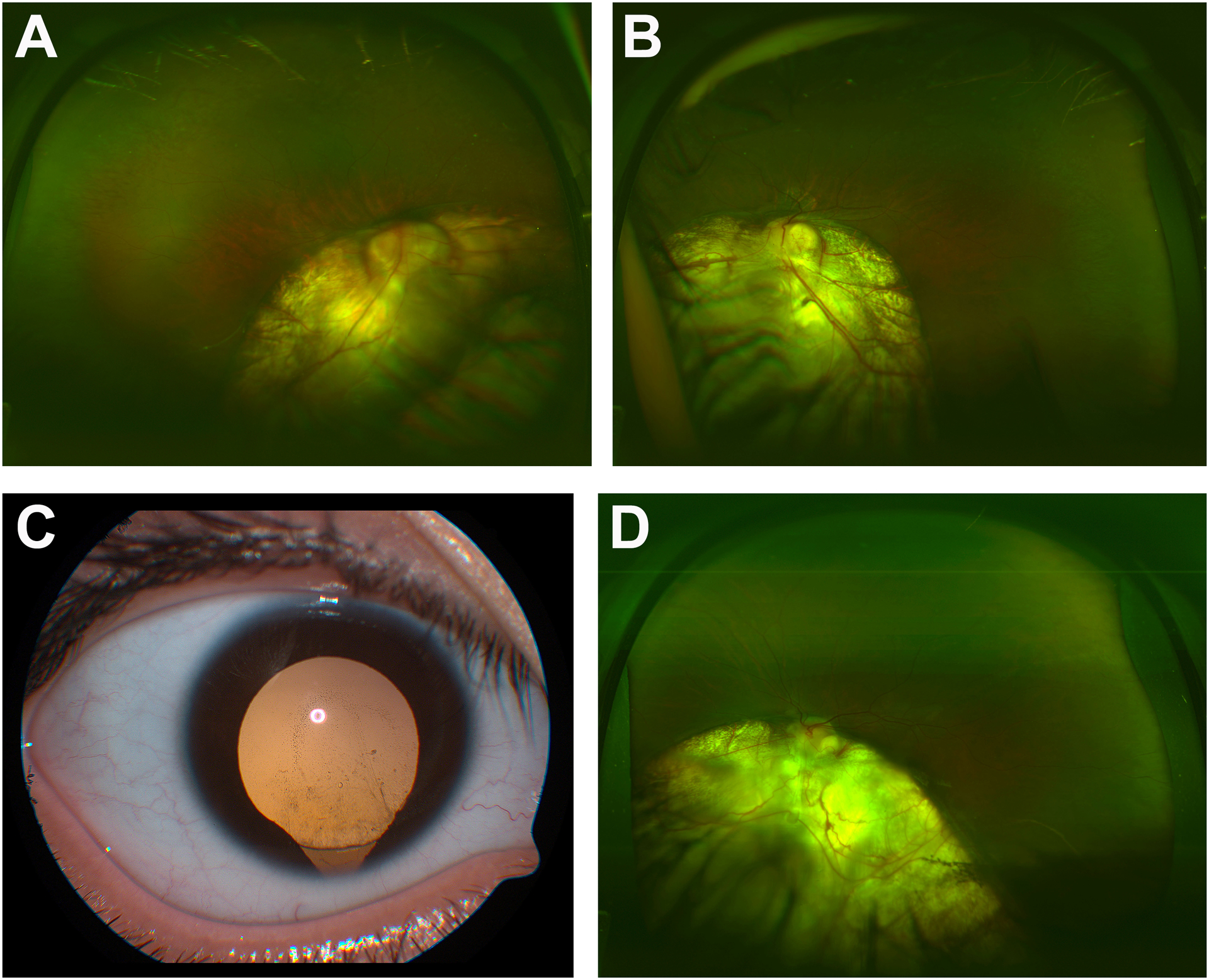 Figure 1: