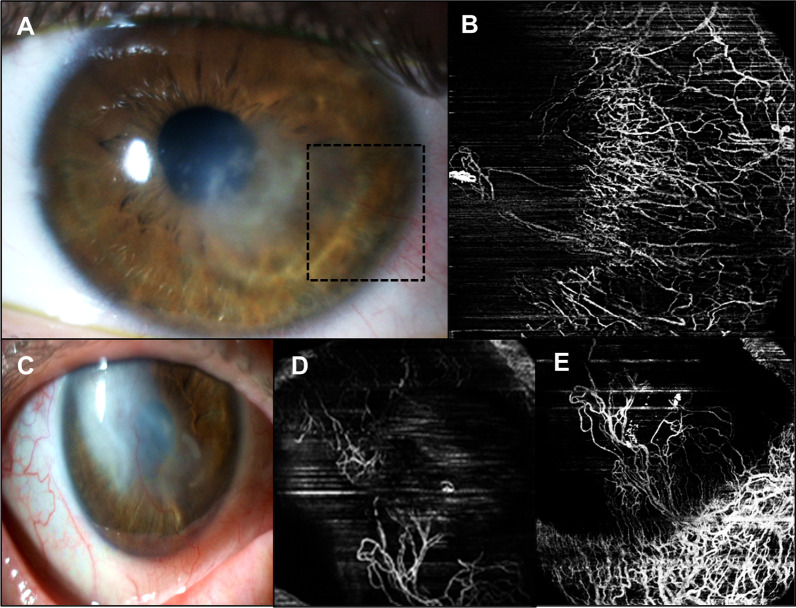 Fig. 4