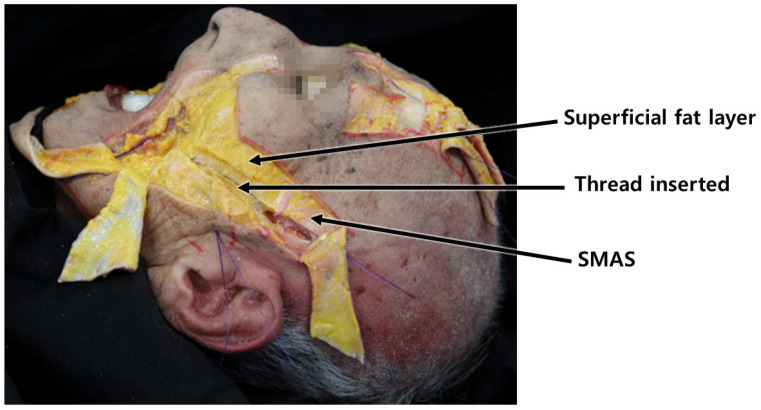 Figure 17