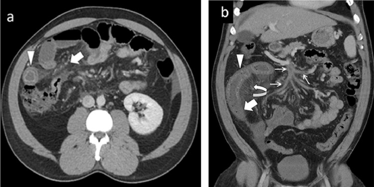 Fig 1 –