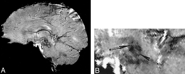 fig 4.