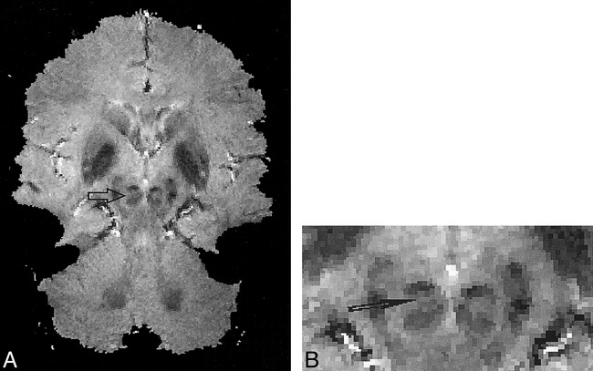 fig 3.