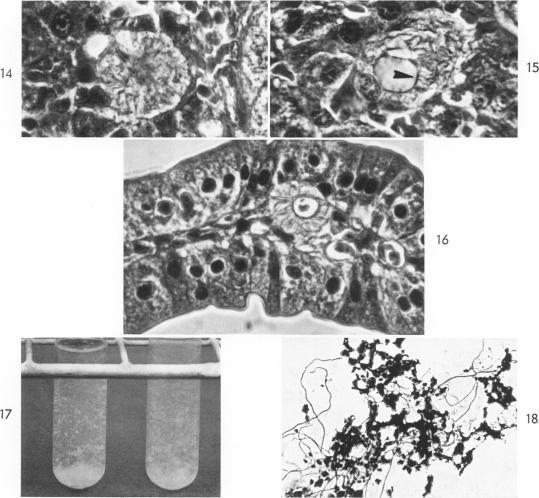 Fig. 14-18