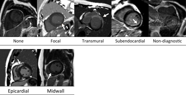 Figure 2: