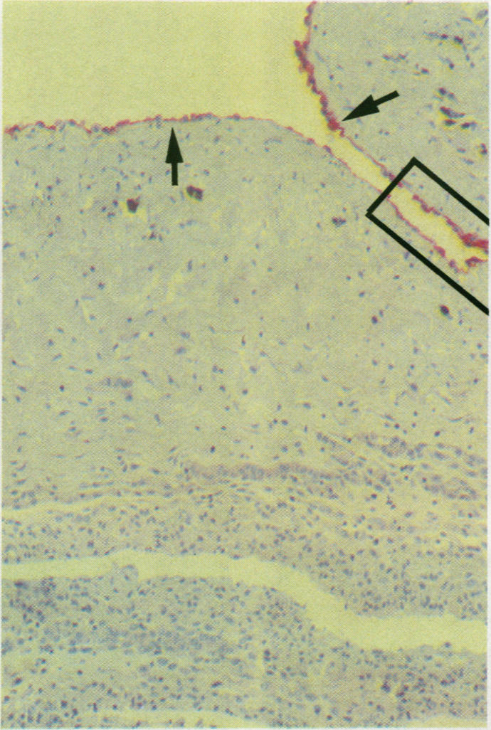 Fig 1b