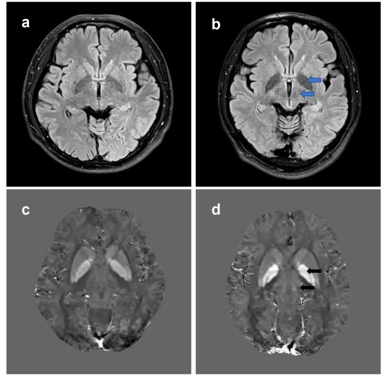 Fig. (2)