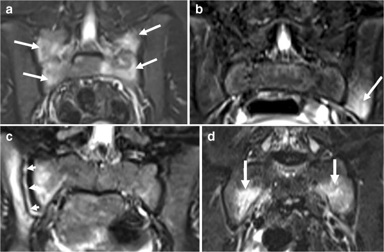 Fig. 4