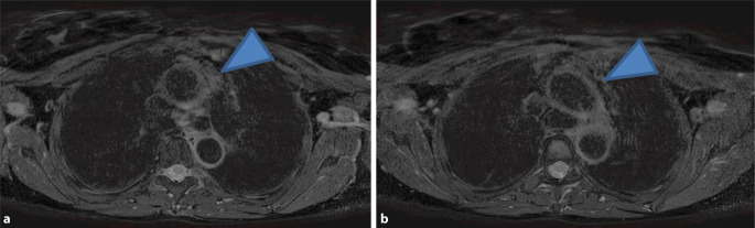 graphic file with name 393_2021_961_Fig1_HTML.jpg