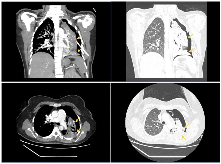 Figure 2.