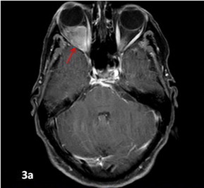 Figure 3a