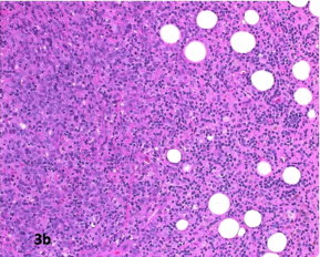 Figure 3b