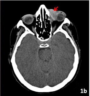 Figure 1b