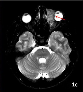 Figure 1c