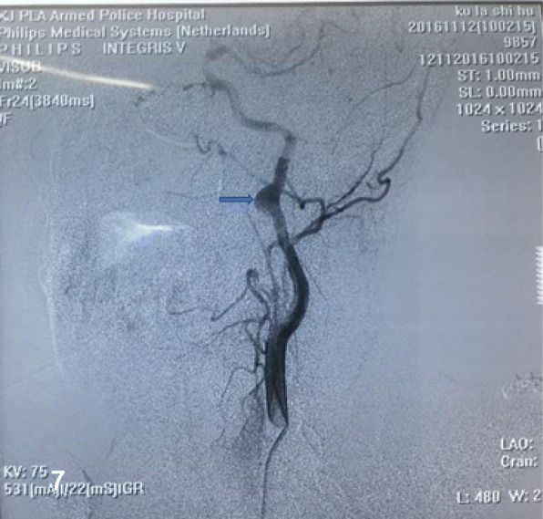 Fig. 7