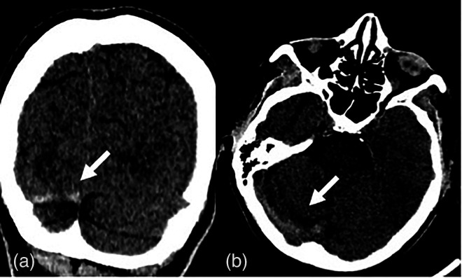 Fig. 2.