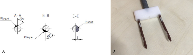FIGURE 1