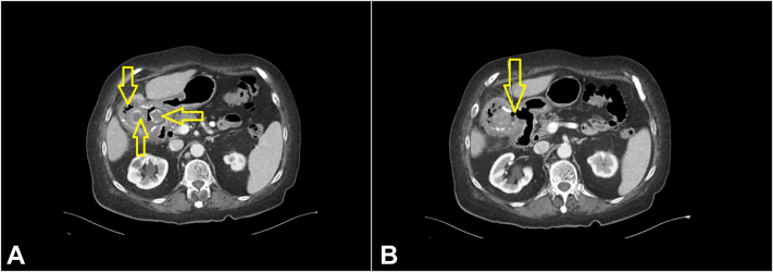 Figure 1