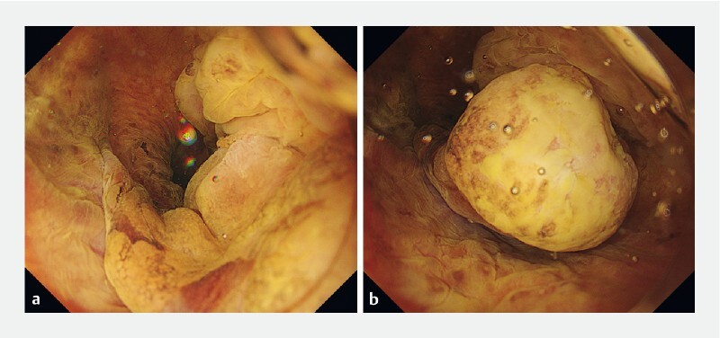 Fig. 3