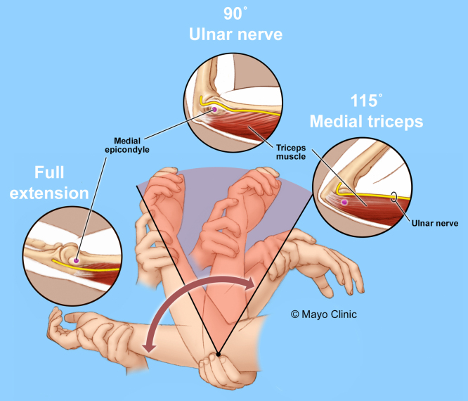 FIG. 2.