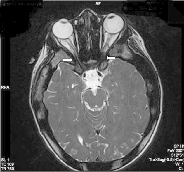 Fig. 2