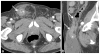 Fig. 11