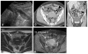 Fig. 14