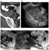 Fig. 13