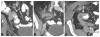 Fig. 16