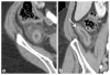 Fig. 15