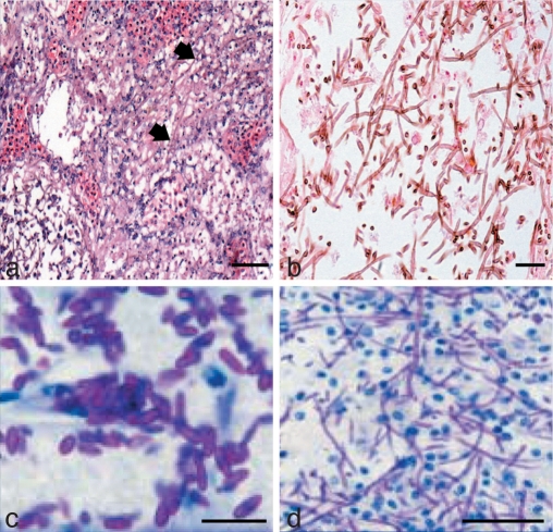 Fig. 16