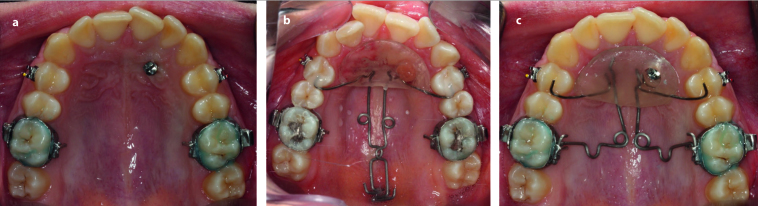 Figure 1. a–c