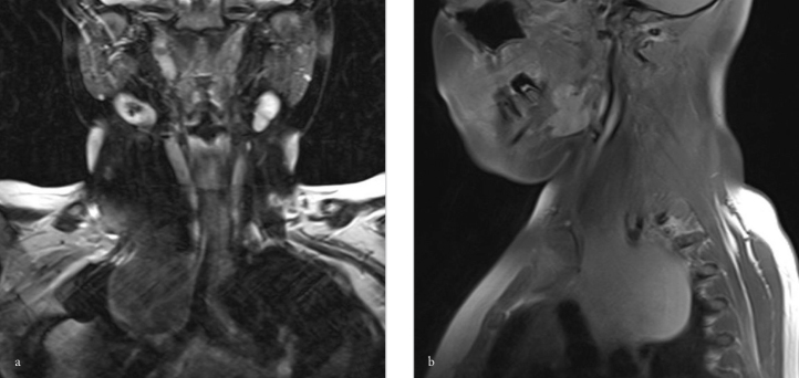 Figure 1. a, b