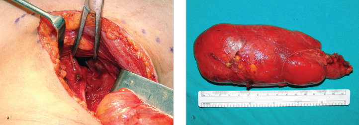 Figure 2. a, b