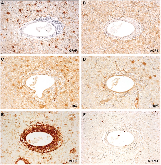 FIGURE 11.