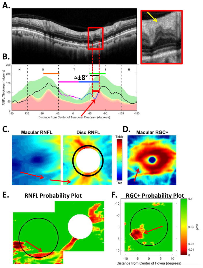 Fig. 9