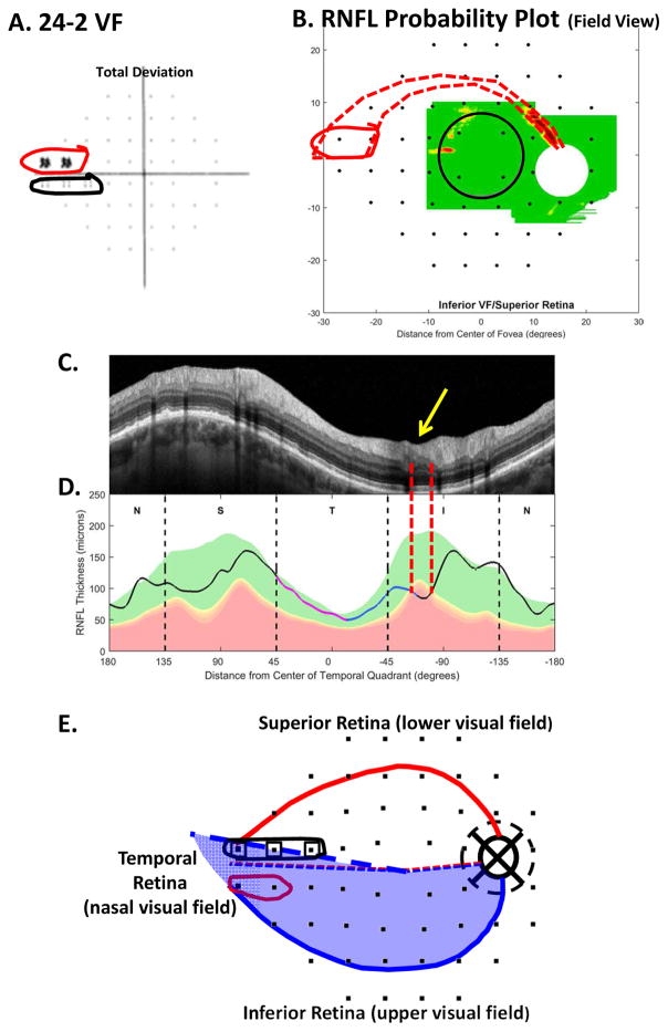 Fig. 18