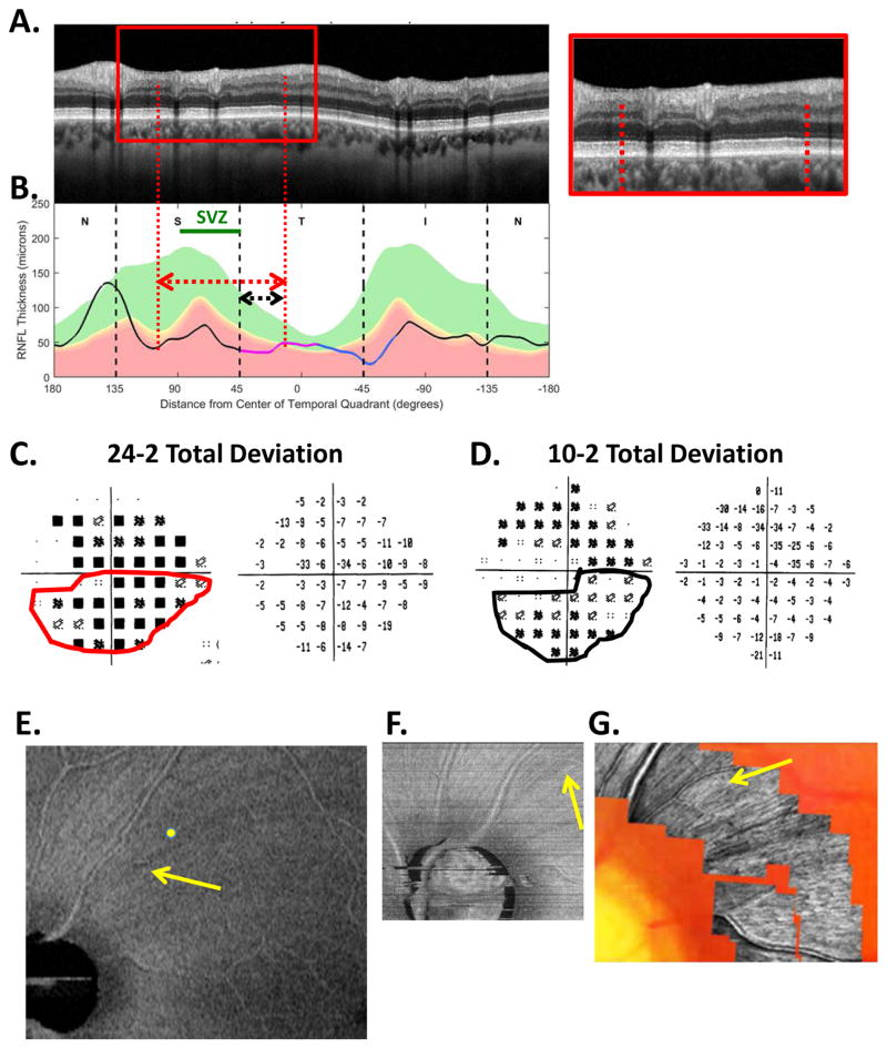 Fig. 19