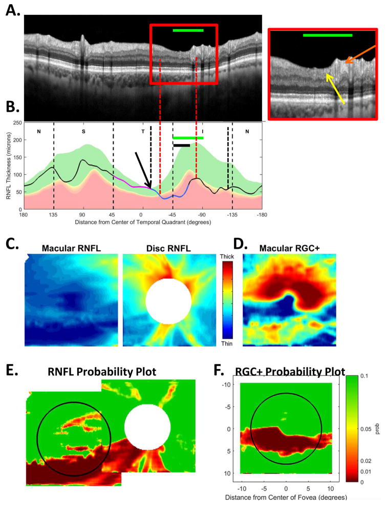 Fig. 10