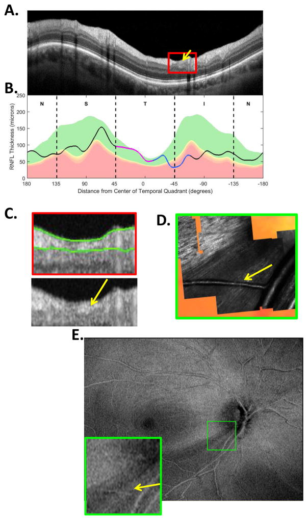 Fig. 11