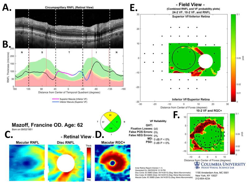 Fig. 20