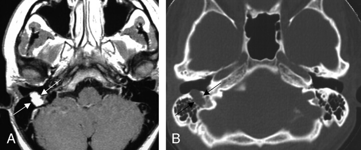 Fig 8.