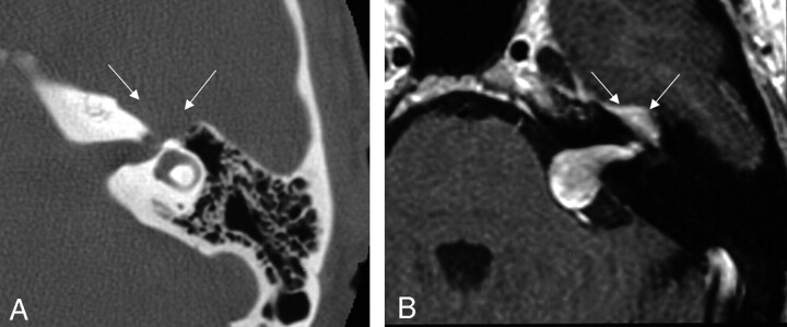 Fig 2.