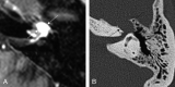Fig 4.
