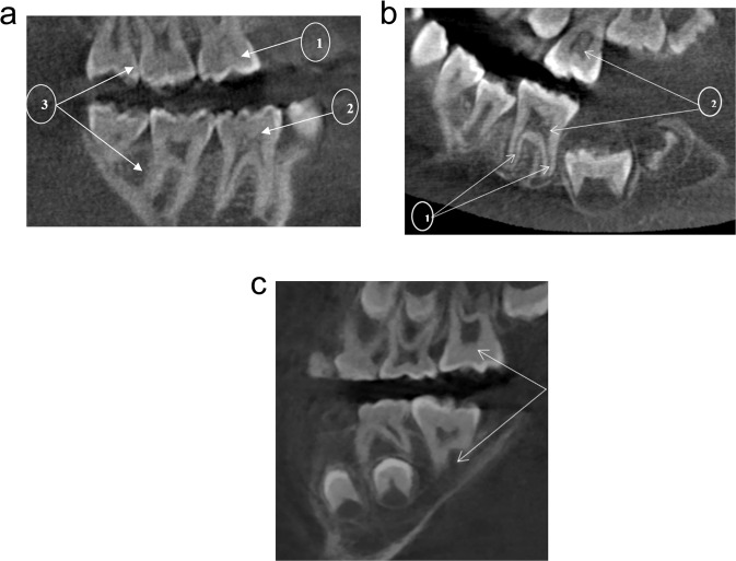 Fig. 2