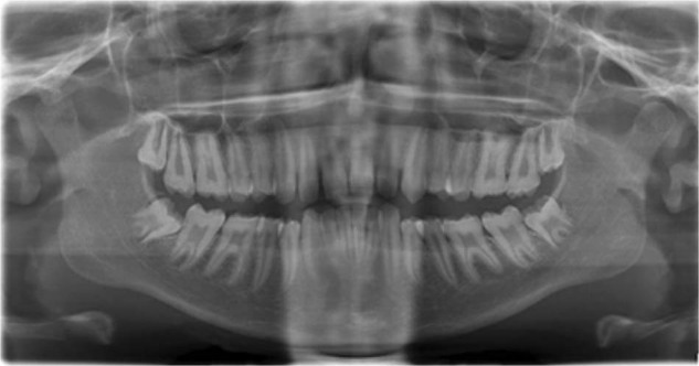 Fig. 3