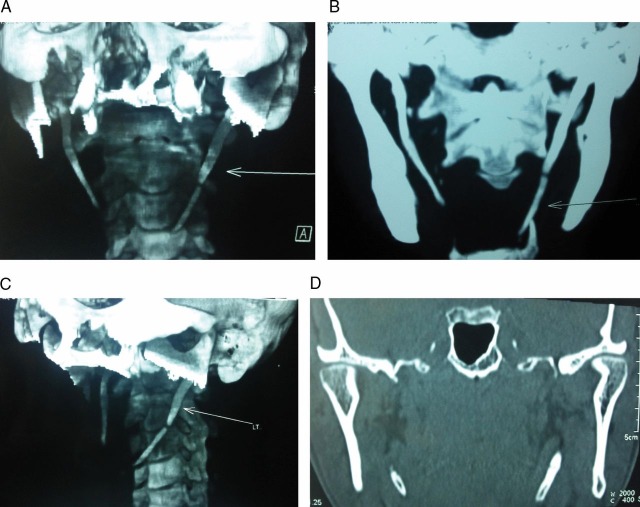 Figure 1