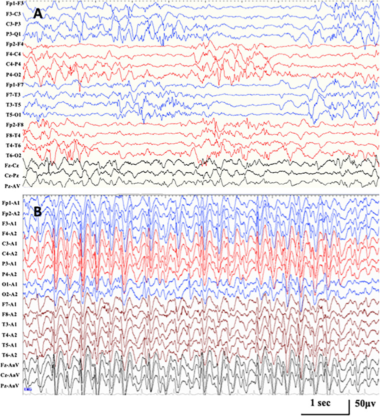 FIGURE 2