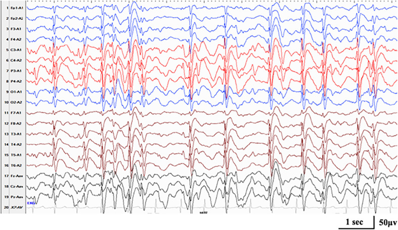 FIGURE 4